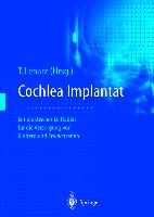 Cochlea-Implantat