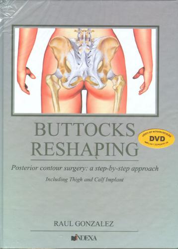 Buttocks Reshaping