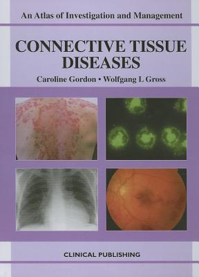 Connective Tissue Diseases