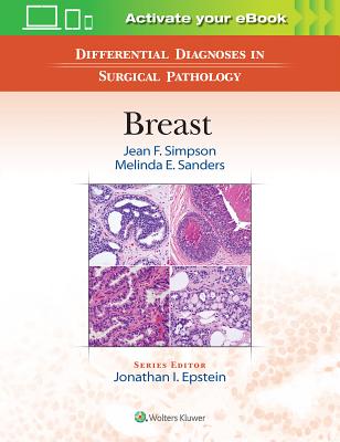 Differential Diagnoses in Surgical Pathology: Breast