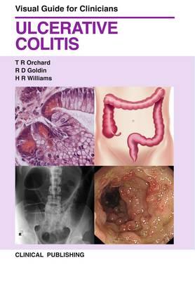 Ulcerative Colitis