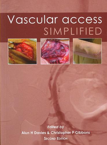 Vascular Access Simplified