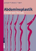 Abdominoplastik