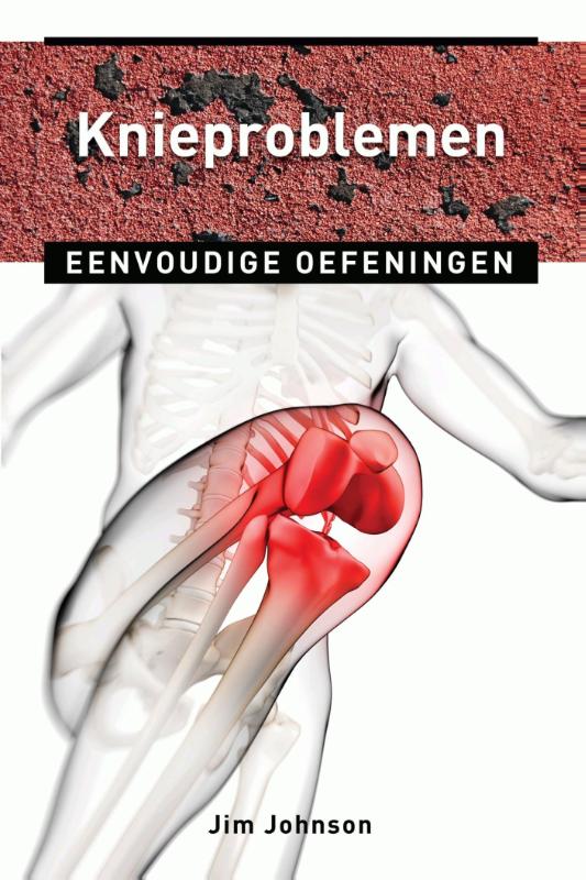 Knieproblemen (Ebook)
